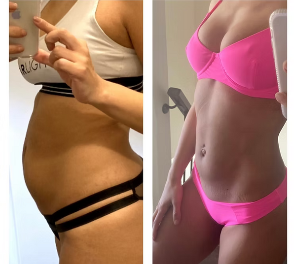 Starlight Body Contouring - 30 Mins