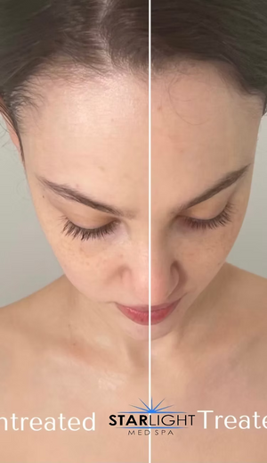 FORMA - Face or Neck