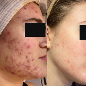 LIQUID GLOW Exfoliating Toner