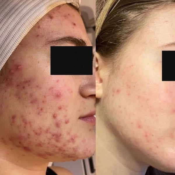 LIQUID GLOW Exfoliating Toner