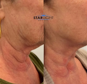 FORMA - Face + Neck