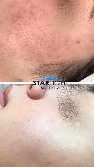 DIAMOND PACKAGE of 3