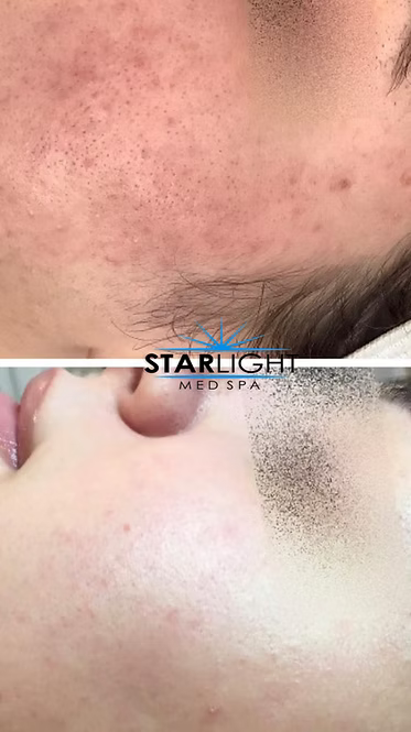 DIAMOND PACKAGE of 3