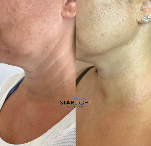 FORMA - Face + Neck