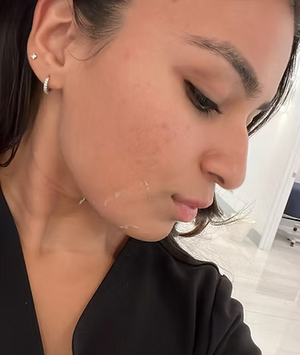 Green Peel (Body)