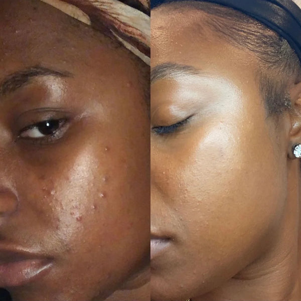 LIQUID GLOW Exfoliating Toner