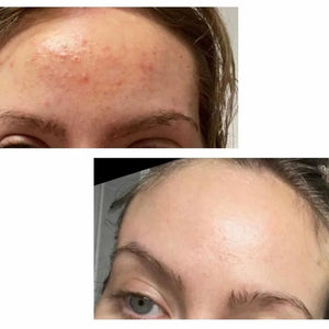 CLEARING CLAY Oil Pulling Mask