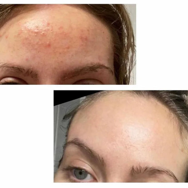 CLEARING CLAY Oil Pulling Mask