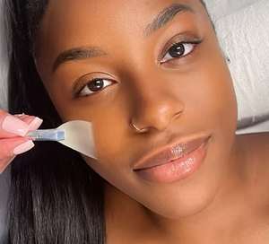 CHEMICAL PEEL