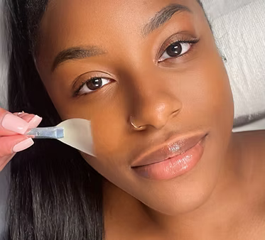 CHEMICAL PEEL