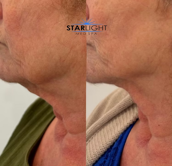 FORMA - Face + Neck
